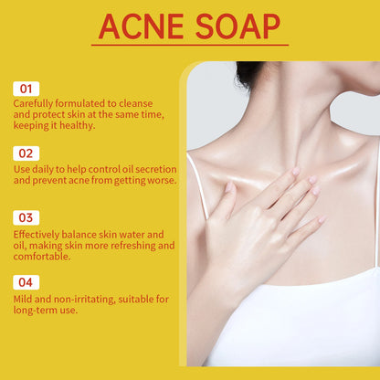 Acne Treatment Soap Deep Cleansing