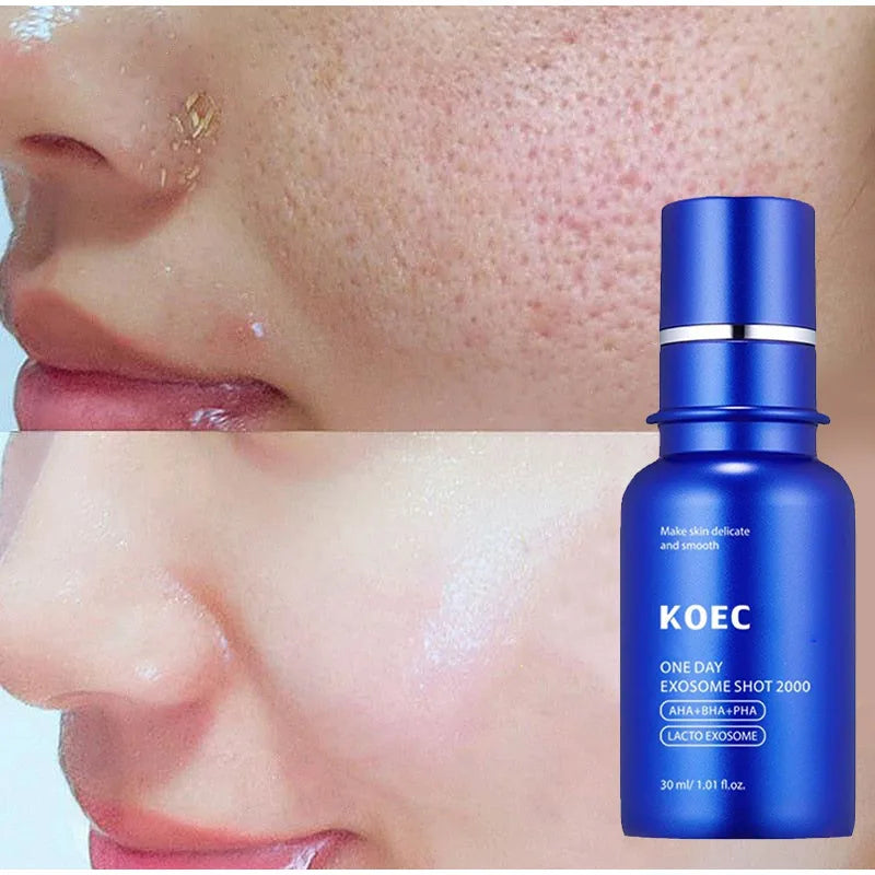 Microneedle Essence Cream Set