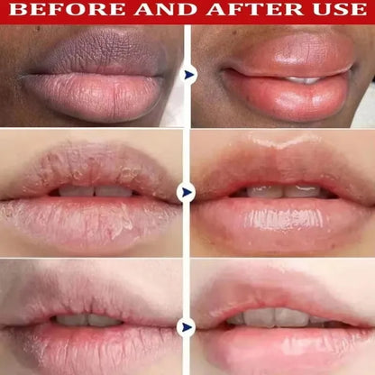 Remove Melanin Brighten Color Lip Stick