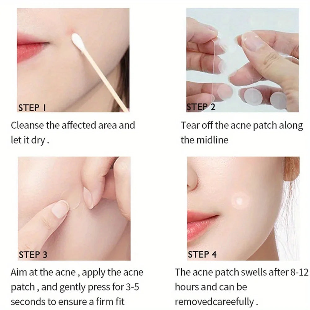 72pcs Acne Patch Set