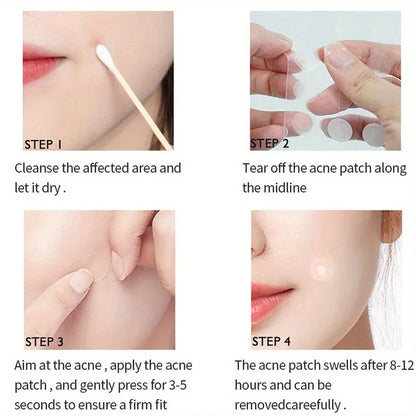 72pcs Acne Patch Set