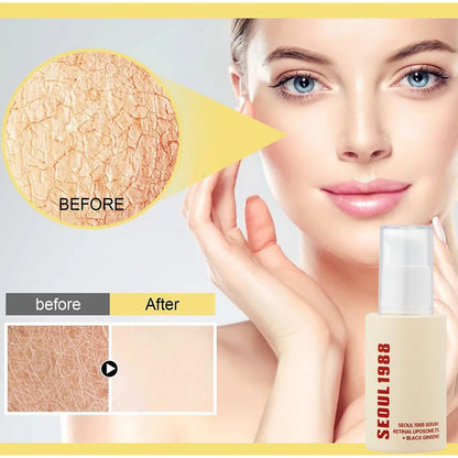 1988 Serum Vitamin C Brightening Cream Fade Melasma Dark Spot