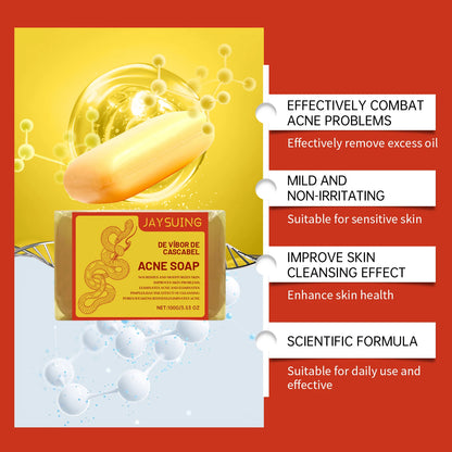 Acne Treatment Soap Deep Cleansing