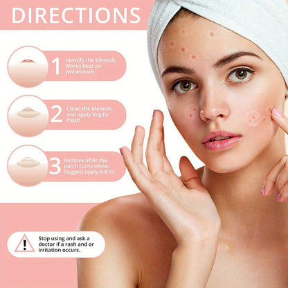 72pcs Acne Patch Set