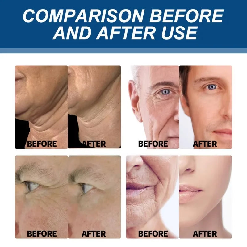 Retinol Anti-wrinkle Cream For Men Collagen Anti-Aging Removal Face