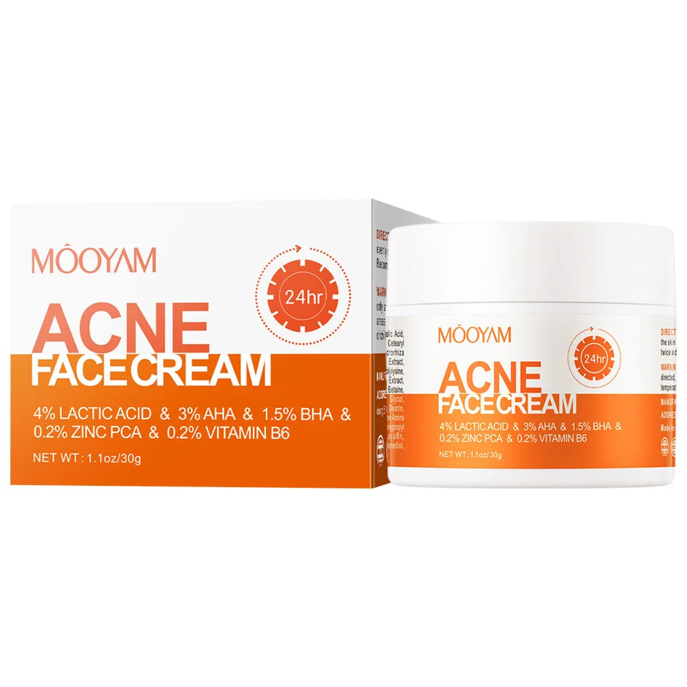 Acne Treatment Cream Anti Acne Face Cream Pimple Removal Spots