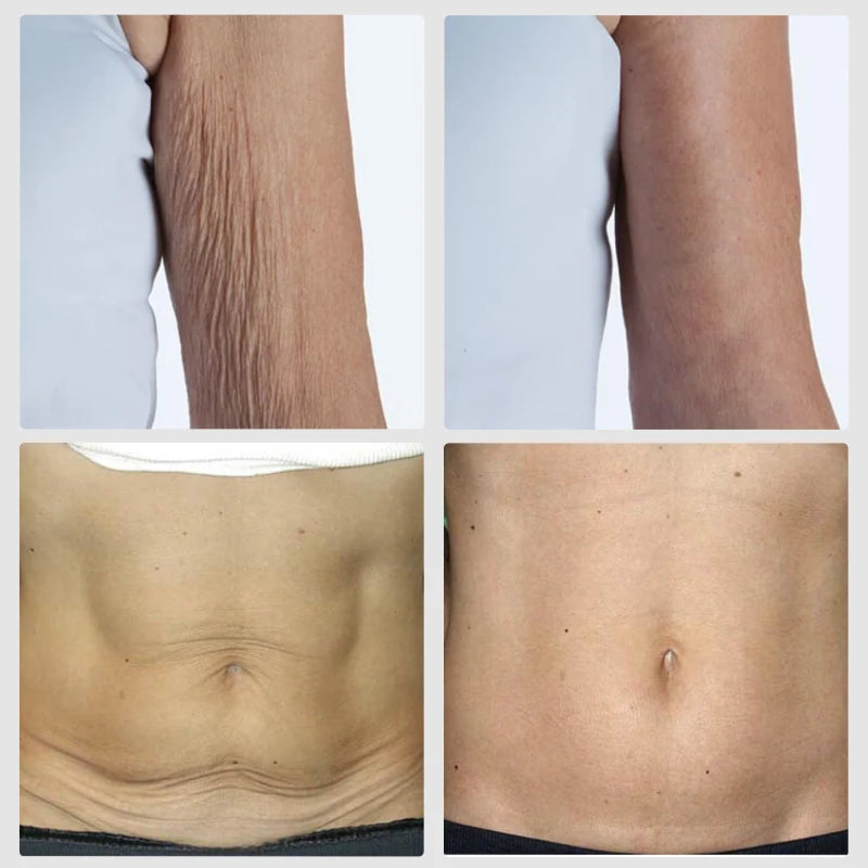 Retinol Vitamin E Body Cream Lifting Tighten Abdominal Shaping Firm Arm
