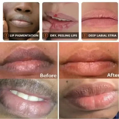 Remove Melanin Brighten Color Lip Stick
