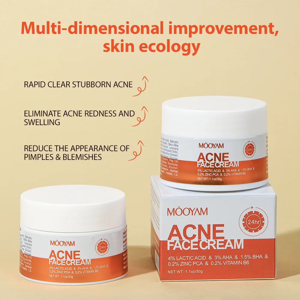 Acne Treatment Cream Anti Acne Face Cream Pimple Removal Spots