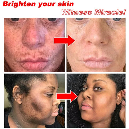 Vitamin C Whitening Freckles Serum Stick Remove Melasma Dark Spots