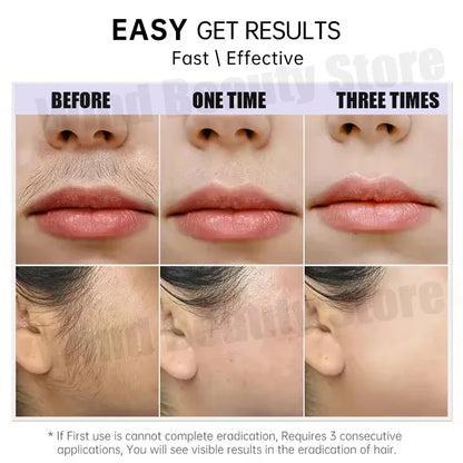 Painless Hair Removal Creams Fast Gentle Removal Skin Care