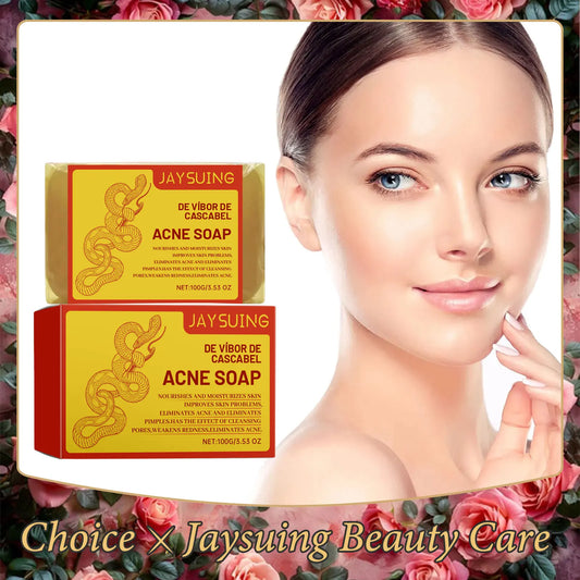 Acne Treatment Soap Deep Cleansing