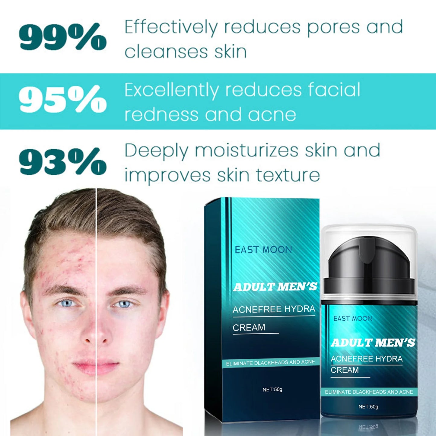Men Anti Acne Cream Oil Control Remove Acne Mark Pimples Fade Black Dots Shrink Pores Refreshing Hydrating Acne Treatment Cream