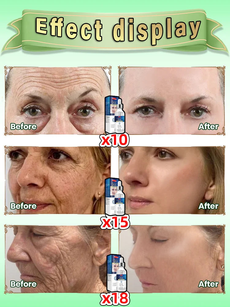 Anti-wrinkle facial essence anti-aging anti-wrinkle essence