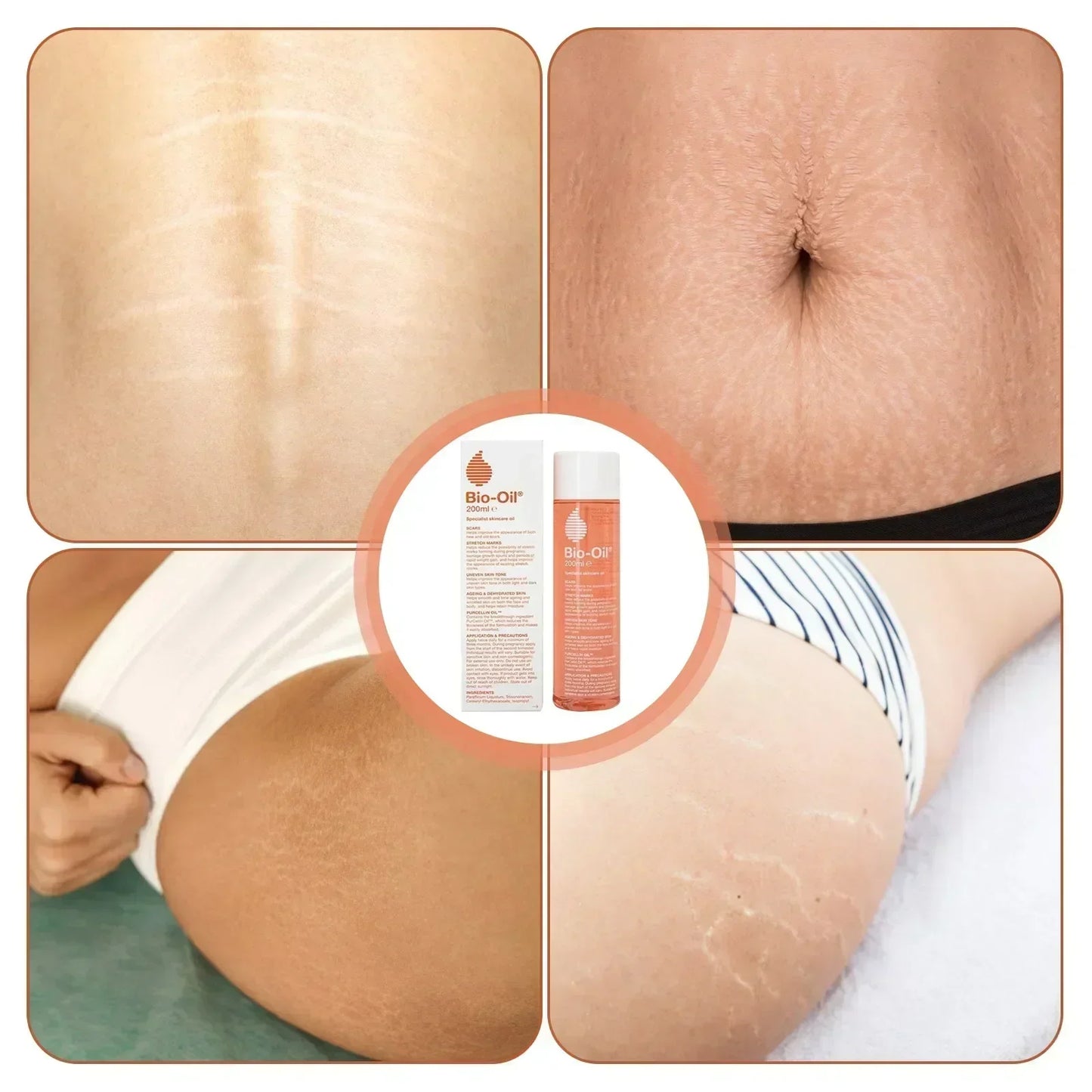 Bio-essential Oil Is Gentle and Non-irritating