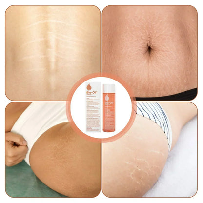 Bio-essential Oil Is Gentle and Non-irritating