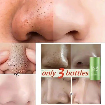 Green Tea Remove Blackhead Solid Mask Dispel Acne Blemish Cleansing