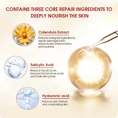 Calendula Face Cream Anti-acne Facial Serum Shrink Pores
