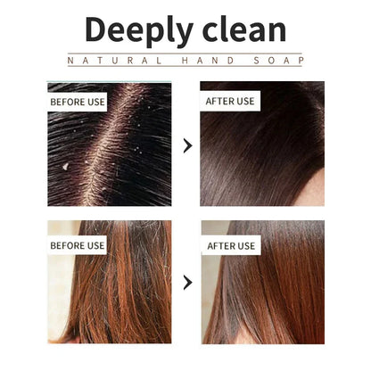 Lavender shampoo is refreshing, oil controlling, and smooth for hair