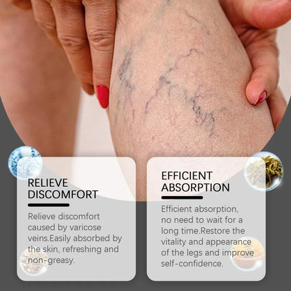 Varicose Veins Relief Cream Gentle Relief of Leg Discomfort Daily Massage Promote Blood Circulation External Use Leg Care Cream