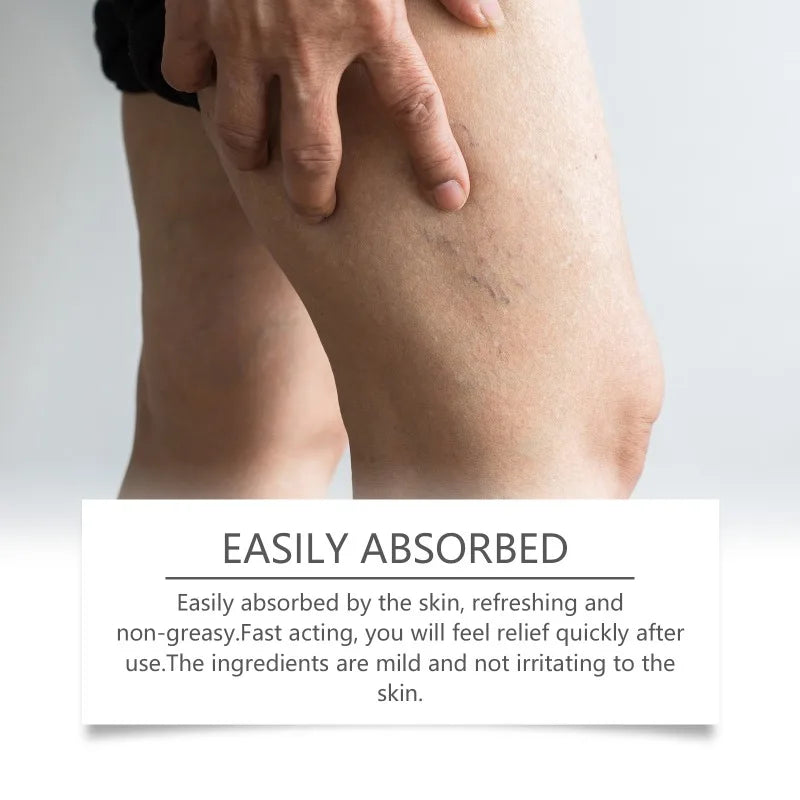 Varicose Veins Relief Cream Gentle Relief of Leg Discomfort Daily Massage Promote Blood Circulation External Use Leg Care Cream