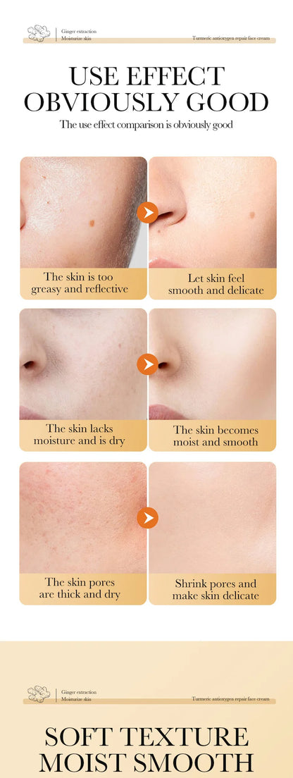 Turmeric Oil Control Skincare Cream Set