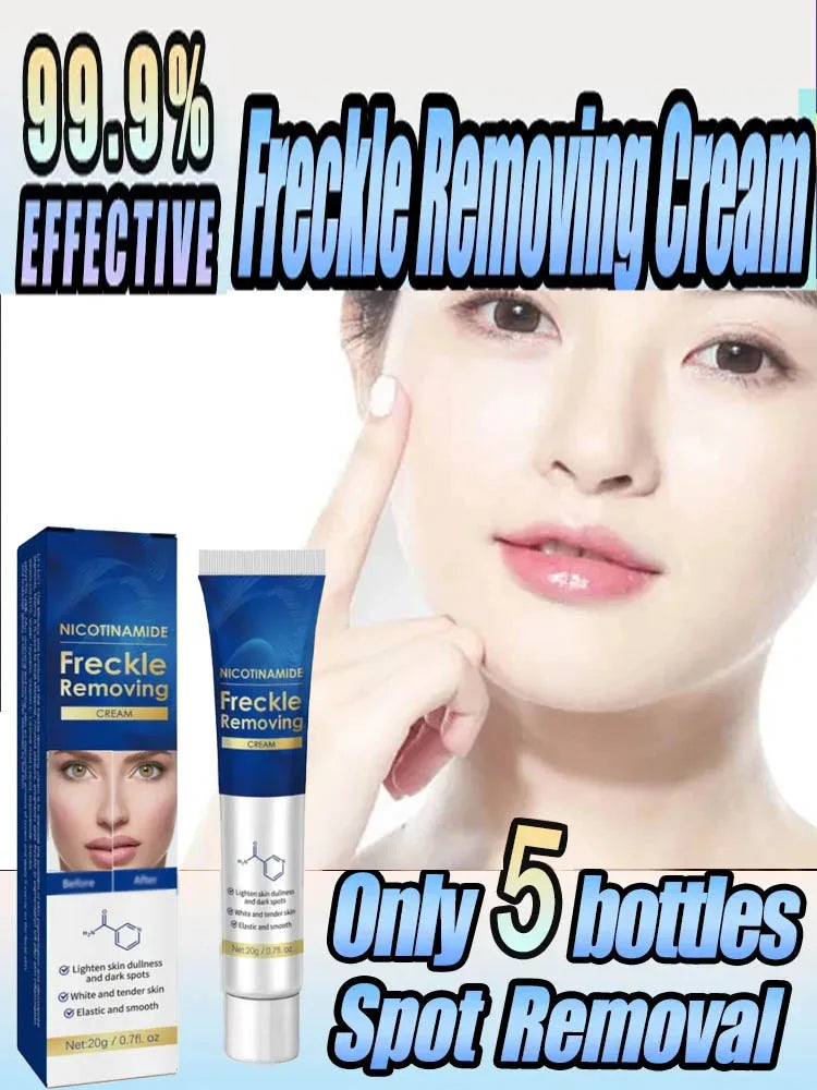 Freckle Removing Cream Blemish Reduces Chloasma Age Spots
